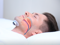 Mann mit Anti-Schnarchgerät am Hals, Schlafapnoe-Therapie, Schlafhilfe, weißer Hintergrund